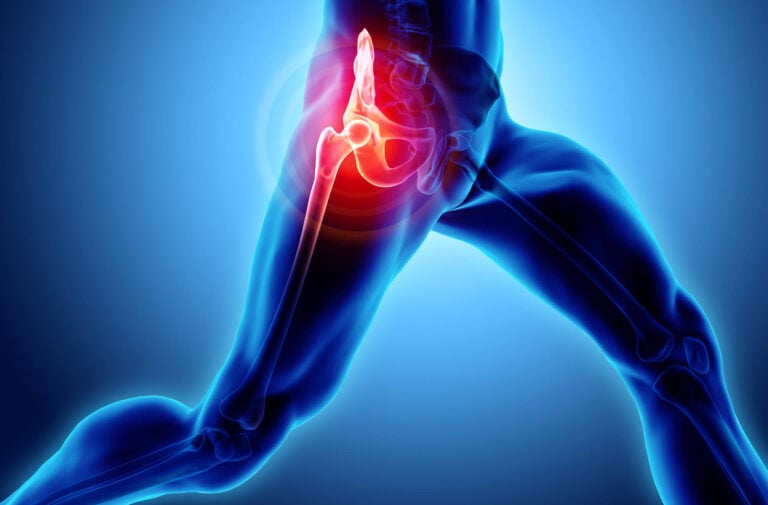 hip pain in marshfield MA