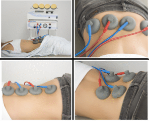 Restore Nerve Function and Alleviate Pain with NeuroMed Matrix Treatment at Dr. Kate McDonough’s Clinic