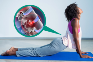 Gentle Solutions for Bulging Discs and Chronic Back Pain